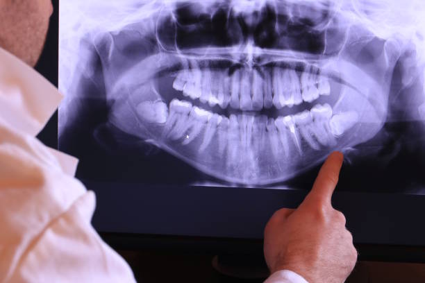 Best Emergency Dental Extractions in Blackwells Mills, NJ
